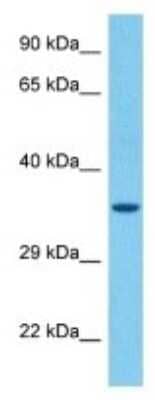 Western Blot: Olfactory receptor 142 Antibody [NBP3-10253] - Western blot analysis of Olfactory receptor 142 in Mouse Brain lysates. Antibody dilution at 1ug/ml