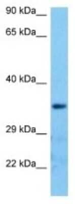 Western Blot: Olfactory receptor 147 Antibody [NBP3-10271] - Western blot analysis of Olfactory receptor 147 in Mouse Testis lysates. Antibody dilution at 1ug/ml