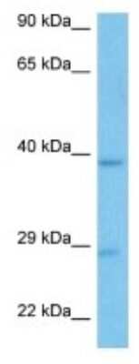 Western Blot: Olfactory receptor 1537 Antibody [NBP3-10239] - Western blot analysis of Olfactory receptor 1537 in Mouse Kidney lysates. Antibody dilution at 1ug/ml