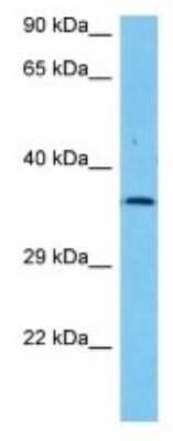 Western Blot: Olfactory receptor 181 Antibody [NBP3-10243] - Western blot analysis of Olfactory receptor 181 in Mouse Lung lysates. Antibody dilution at 1ug/ml
