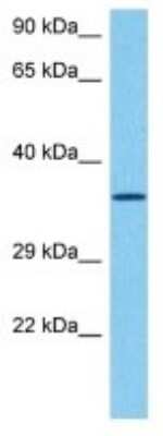 Western Blot: Olfactory receptor 478 Antibody [NBP3-10270] - Western blot analysis of Olfactory receptor 478 in Mouse Small Intestine lysates. Antibody dilution at 1ug/ml