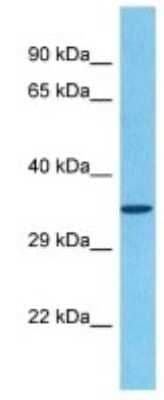 Western Blot: Olfactory receptor 481 Antibody [NBP3-10255] - Western blot analysis of Olfactory receptor 481 in Mouse Brain lysates. Antibody dilution at 1ug/ml