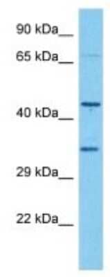 Western Blot: Olfactory receptor 490 Antibody [NBP3-10269] - Western blot analysis of Olfactory receptor 490 in Mouse Heart lysates. Antibody dilution at 1ug/ml
