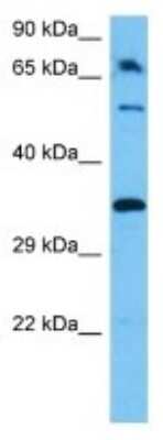 Western Blot: Olfactory receptor 491 Antibody [NBP3-10248] - Western blot analysis of Olfactory receptor 491 in Mouse Stomach lysates. Antibody dilution at 1ug/ml