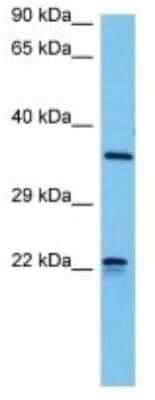 Western Blot: Olfactory receptor 510 Antibody [NBP3-10246] - Western blot analysis of Olfactory receptor 510 in Mouse Stomach lysates. Antibody dilution at 1ug/ml