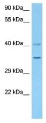 Western Blot: Olfactory receptor 6 Antibody [NBP3-10066] - Western blot analysis of Olfactory receptor 6 in Mouse Kidney lysates. Antibody dilution at 1ug/ml