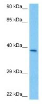 Western Blot: Olfactory receptor 867 Antibody [NBP3-10229] - Western blot analysis of Olfactory receptor 867 in Mouse Liver lysates. Antibody dilution at 1ug/ml