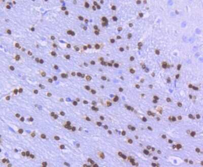 Immunohistochemistry-Paraffin: Olig2 Antibody (SP07-02) [NBP2-67377] - Analysis of paraffin-embedded rat brain tissue using anti-Olig2 antibody. Counter stained with hematoxylin.