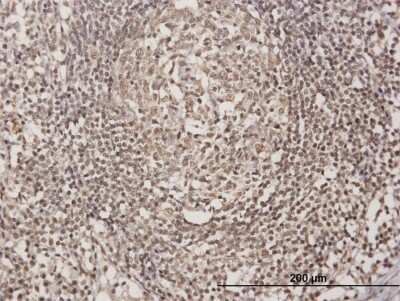 Immunohistochemistry-Paraffin: Olig3 Antibody [H00167826-B01P] - Analysis of purified antibody to OLIG3 on formalin-fixed paraffin-embedded human lymph node. (antibody concentration 3 ug/ml)