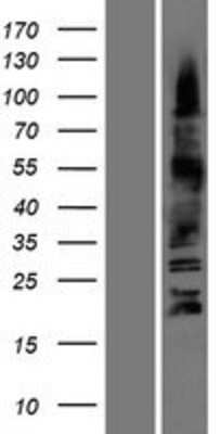 Western Blot: Olig3 Overexpression Lysate (Adult Normal) [NBP2-05055] Left-Empty vector transfected control cell lysate (HEK293 cell lysate); Right -Over-expression Lysate for Olig3.