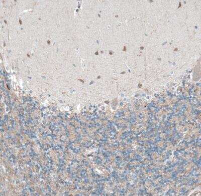Immunohistochemistry-Paraffin: Oncomodulin Antibody [NBP2-14568] - Staining of human cerebellum shows weak to moderate cytoplasmic positivity in cells in molecular layer.