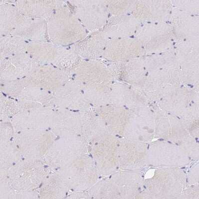 Immunohistochemistry-Paraffin: Oncomodulin Antibody [NBP2-14568] - Staining of human skeletal muscle shows no positivity in myocytes as expected.