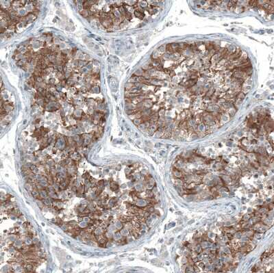 Immunohistochemistry-Paraffin Oncomodulin Antibody - BSA Free