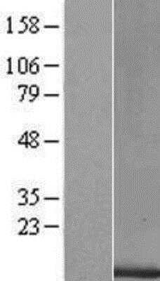 Western Blot: Oncomodulin/OCM2 Overexpression Lysate (Native) [NBP2-10425] - Oncomodulin/OCM2 Overexpression Lysate (Native) Left-Empty vector transfected control cell lysate (HEK293 cell lysate); Right -Over-expression Lysate for Oncomodulin.
