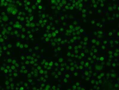 Immunocytochemistry/Immunofluorescence: Oncostatin M/OSM Antibody (015) [NBP2-89506] - Staining of OSM in jurkat cells. Cells were fixed with 4% PFA, permeabilzed with 0.1% Triton X-100 in PBS,blocked with 10% serum, and incubated with rabbit anti-human OSM monoclonal antibody (dilution ratio 1:60) at 4c overnight. Then cells were stained with the Alexa Fluor(R)488-conjugated Goat Anti-rabbit IgG secondary antibody (green). Positive staining was localized to Cytoplasm .