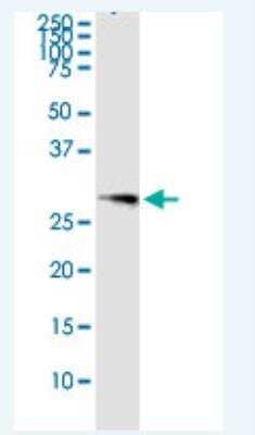 Immunoprecipitation: Oncostatin M/OSM Antibody [H00005008-D01] - OSM transfected lysate using anti-OSM MaxPab rabbit polyclonal antibody and Protein A Magnetic Bead (U0007), and immunoblotted with OSM purified MaxPab mouse polyclonal antibody (B02P) (H00005008-B02P).