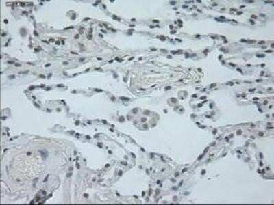 Immunohistochemistry: Oncostatin M/OSM Antibody (OTI2B6) - Azide and BSA Free [NBP2-73146] - Staining of paraffin-embedded lung tissue using anti-Oncostatin M mouse monoclonal antibody.
