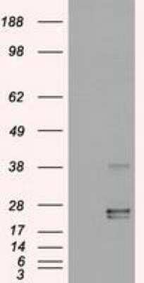 Western Blot: Oncostatin M/OSM Antibody (OTI2B6) - Azide and BSA Free [NBP2-73146] - HEK293T cells were transfected with the pCMV6-ENTRY control (Left lane) or pCMV6-ENTRY Oncostatin M (Right lane) cDNA for 48 hrs and lysed. Equivalent amounts of cell lysates (5 ug per lane) were separated by SDS-PAGE and immunoblotted with anti-Oncostati