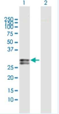 Western Blot: Oncostatin M/OSM Antibody [H00005008-D01] - Analysis of OSM expression in transfected 293T cell line (H00005008-T02) by OSM MaxPab polyclonal antibody.  Lane 1: OSM transfected lysate(28.50 KDa).  Lane 2: Non-transfected lysate.