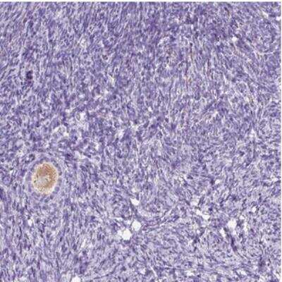 Immunohistochemistry: Oocyte Expressed Protein Antibody [NBP2-30762] - Staining of human ovary shows moderate cytoplasmic positivity in oocyte.