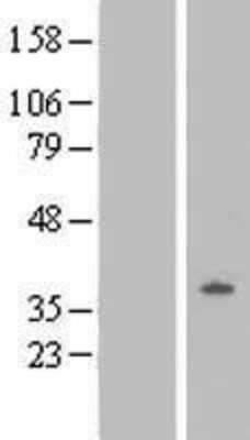 Western Blot: Oprl1 Overexpression Lysate (Adult Normal) [NBL1-13944] Left-Empty vector transfected control cell lysate (HEK293 cell lysate); Right -Over-expression Lysate for Oprl1.