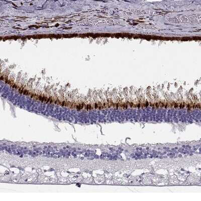 Immunohistochemistry-Paraffin: Opsin 5 Antibody [NBP2-55250] - Staining of human eye, retina shows strong cytoplasmic positivity in photoreceptor cells.