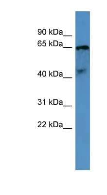 Western Blot: Opsin 5 Antibody [NBP1-69038] - Human Brain lysate, concentration 0.2-1 ug/ml.