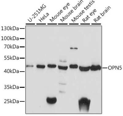 Western Blot Opsin 5 Antibody - Azide and BSA Free