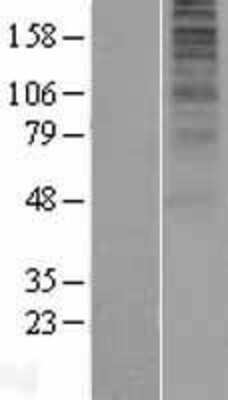 Western Blot Opsin 5 Overexpression Lysate