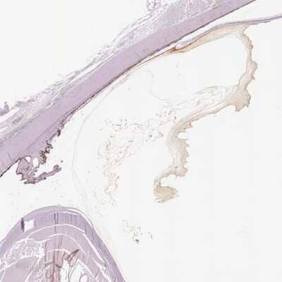 Immunohistochemistry-Paraffin: Opticin Antibody [NBP1-85914] - Staining of human eye shows strong positivity in vitreous of the eye. .