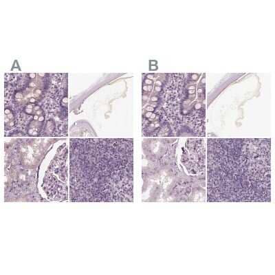 <b>Independent Antibodies Validation. </b>Immunohistochemistry-Paraffin: Opticin Antibody [NBP1-85914] - Staining of human duodenum, eye, kidney and lymph node using Anti-OPTC antibody NBP1-85914 (A) shows similar protein distribution across tissues to independent antibody NBP2-55115 (B).