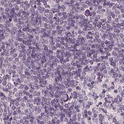 Immunohistochemistry-Paraffin: Opticin Antibody [NBP1-85914] - Staining of human lymph node.