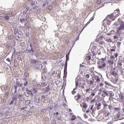 Immunohistochemistry-Paraffin: Opticin Antibody [NBP1-85914] - Staining of human kidney.