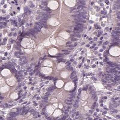 Immunohistochemistry-Paraffin: Opticin Antibody [NBP1-85914] - Staining of human duodenum.