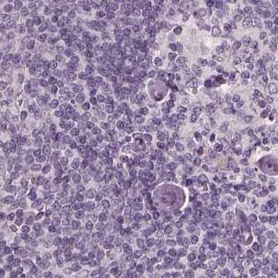 Immunohistochemistry-Paraffin: Opticin Antibody [NBP2-55115] - Staining of human lymph node.