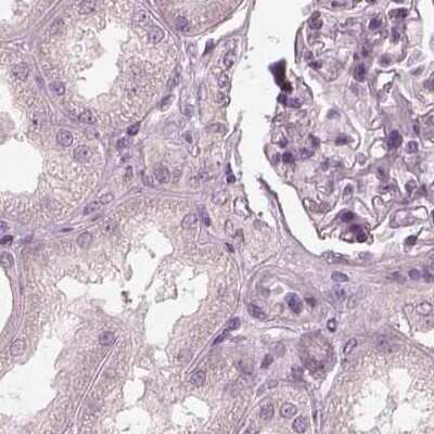 Immunohistochemistry-Paraffin: Opticin Antibody [NBP2-55115] - Staining of human kidney.