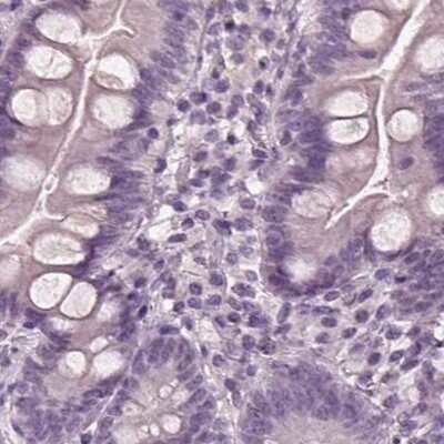 Immunohistochemistry-Paraffin: Opticin Antibody [NBP2-55115] - Staining of human duodenum.