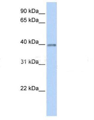 Western Blot: Opticin Antibody [NBP1-79568] - Human Heart lysate, concentration 0.2-1 ug/ml.