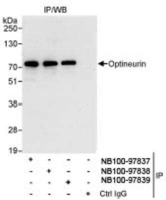 Immunoprecipitation: Optineurin Antibody [NB100-97837] - Detection of Human Optineurin by Western Blot of  Immunoprecipitates. Samples: Whole cell lysate (1 mg for IP,  20% of IP loaded) from HeLa cells. Antibodies: Affinity purified  rabbit anti-Optineurin antibody NB100-97837 used for IP at 3  mcg/mg lysate. Optineurin was also immunoprecipitated by  rabbit anti-Optineurin antibodies NB100-97838 and NB100-97839,  which recognize downstream epitopes. Detection: Chemiluminescence with  an exposure time of 30 seconds.