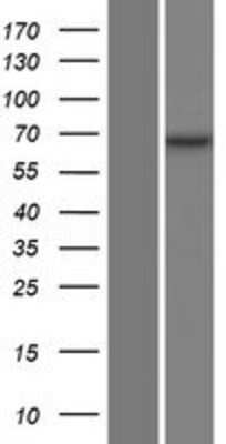 Western Blot: Optineurin Overexpression Lysate (Adult Normal) [NBP2-06486] Left-Empty vector transfected control cell lysate (HEK293 cell lysate); Right -Over-expression Lysate for Optineurin.
