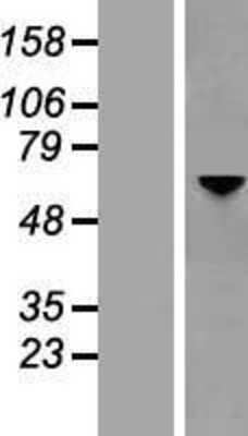 Western Blot: Optineurin Overexpression Lysate (Adult Normal) [NBP2-10995] Left-Empty vector transfected control cell lysate (HEK293 cell lysate); Right -Over-expression Lysate for Optineurin.