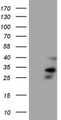 Western Blot: Orai2 Antibody (8D11) [NBP2-46295] - Analysis of HEK293T cells were transfected with the pCMV6-ENTRY control (Left lane) or pCMV6-ENTRY ORAI2.