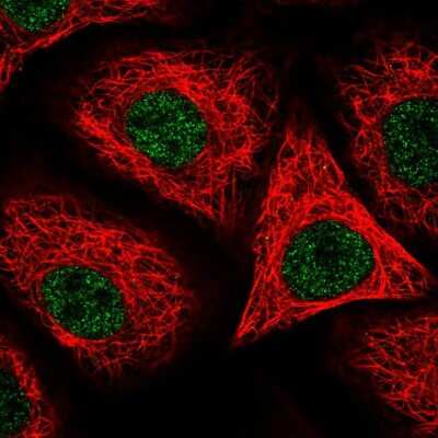 Immunocytochemistry/Immunofluorescence: Orai2 Antibody [NBP2-55443] - Staining of human cell line A549 shows localization to nucleoplasm.