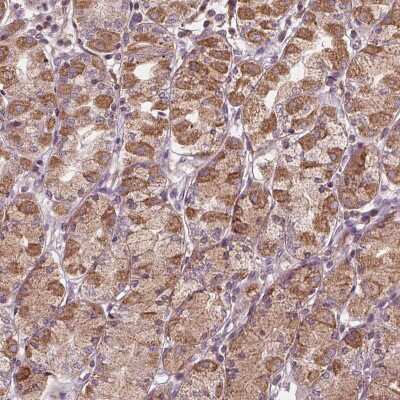 Immunohistochemistry: Orai2 Antibody [NBP2-39064] - Staining of human stomach shows moderate cytoplasmic positivity in glandular cells.