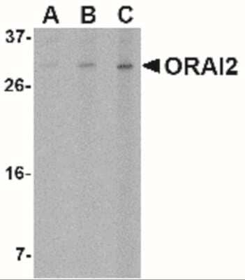 Western Blot: Orai2 Antibody [NBP1-77283] - Analysis of ORAI2 in Jurkat cell lysate with ORAI2 antibody at (A) 1, (B) 2 and (C) 4 ug/mL.