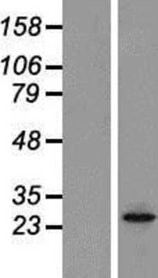 Western Blot: Orai2 Overexpression Lysate (Adult Normal) [NBP2-05967] Left-Empty vector transfected control cell lysate (HEK293 cell lysate); Right -Over-expression Lysate for Orai2.