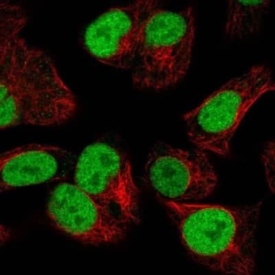 Immunocytochemistry/Immunofluorescence: Orc2 Antibody [NBP2-56503] - Staining of human cell line Hep G2 shows localization to nucleoplasm.