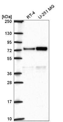 Western Blot: Orc2 Antibody [NBP2-56503] - Analysis in human cell line RT-4 and human cell line U-251 MG.