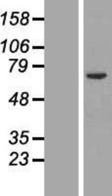 Western Blot: Orc2 Overexpression Lysate (Adult Normal) [NBL1-13973] Left-Empty vector transfected control cell lysate (HEK293 cell lysate); Right -Over-expression Lysate for Orc2.