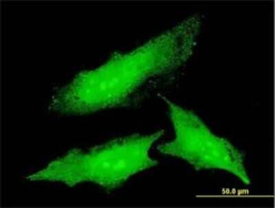 Immunocytochemistry/Immunofluorescence: Ornithine Decarboxylase Antibody (2G5) [H00004953-M01] - Analysis of monoclonal antibody to ODC1 on HeLa cell . Antibody concentration 10 ug/ml.